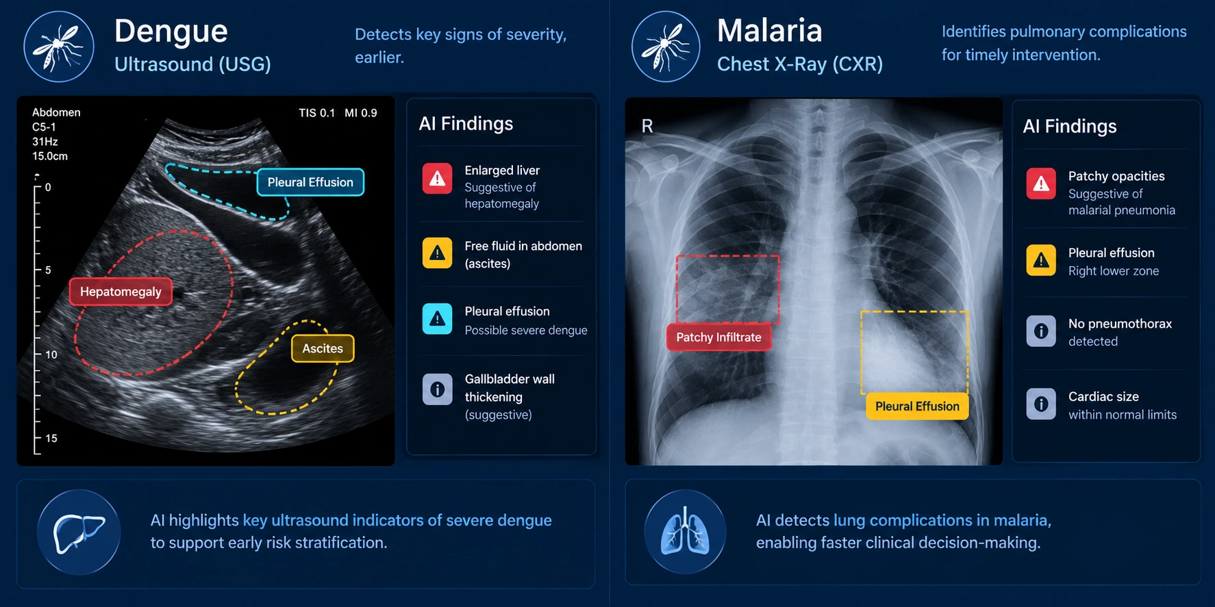 Infectious Disease clinical illustration