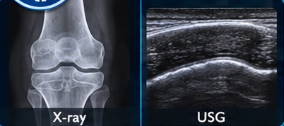 Bone health illustration
