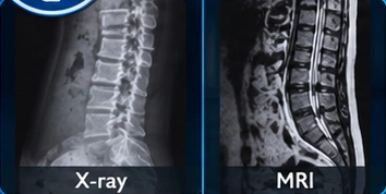 Spine illustration